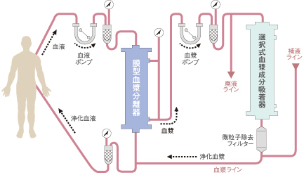 血液および血漿のフロー図