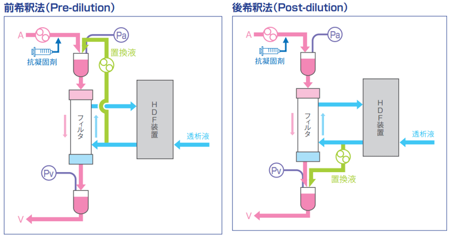 血液透析濾過(HDF)装置のイメージ図
